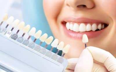Who Should You See for Cosmetic Dentistry in St. Johns FL?